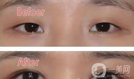 中山美南華醫(yī)院怎么樣 優(yōu)惠整形價格表一覽