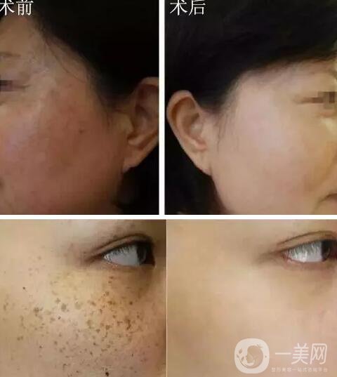 中山美南華醫(yī)院怎么樣 優(yōu)惠整形價格表一覽