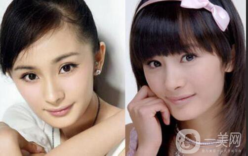 又一個(gè)整容失敗的女明星，鼻子都整歪了，不甘心揚(yáng)言還要植發(fā)！