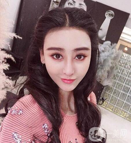又一個(gè)整容失敗的女明星，鼻子都整歪了，不甘心揚(yáng)言還要植發(fā)！