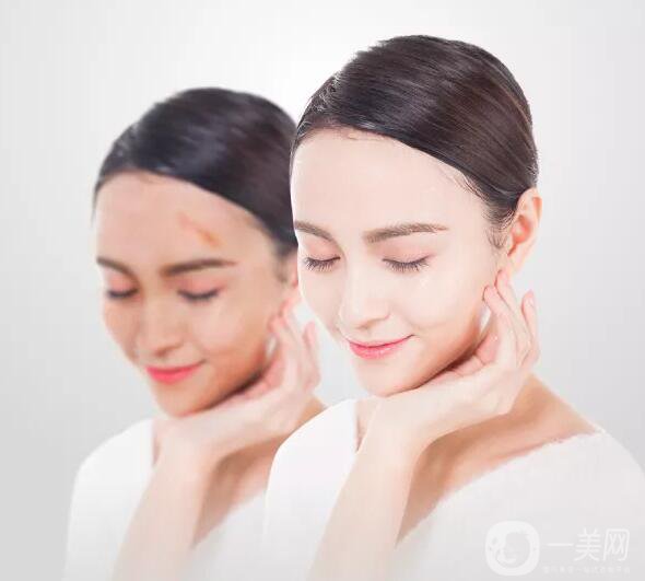 增生疤痕注意事項(xiàng)有哪些？該如何預(yù)防及調(diào)節(jié)？