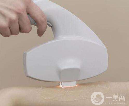 關(guān)于激光脫毛的常見問題解答