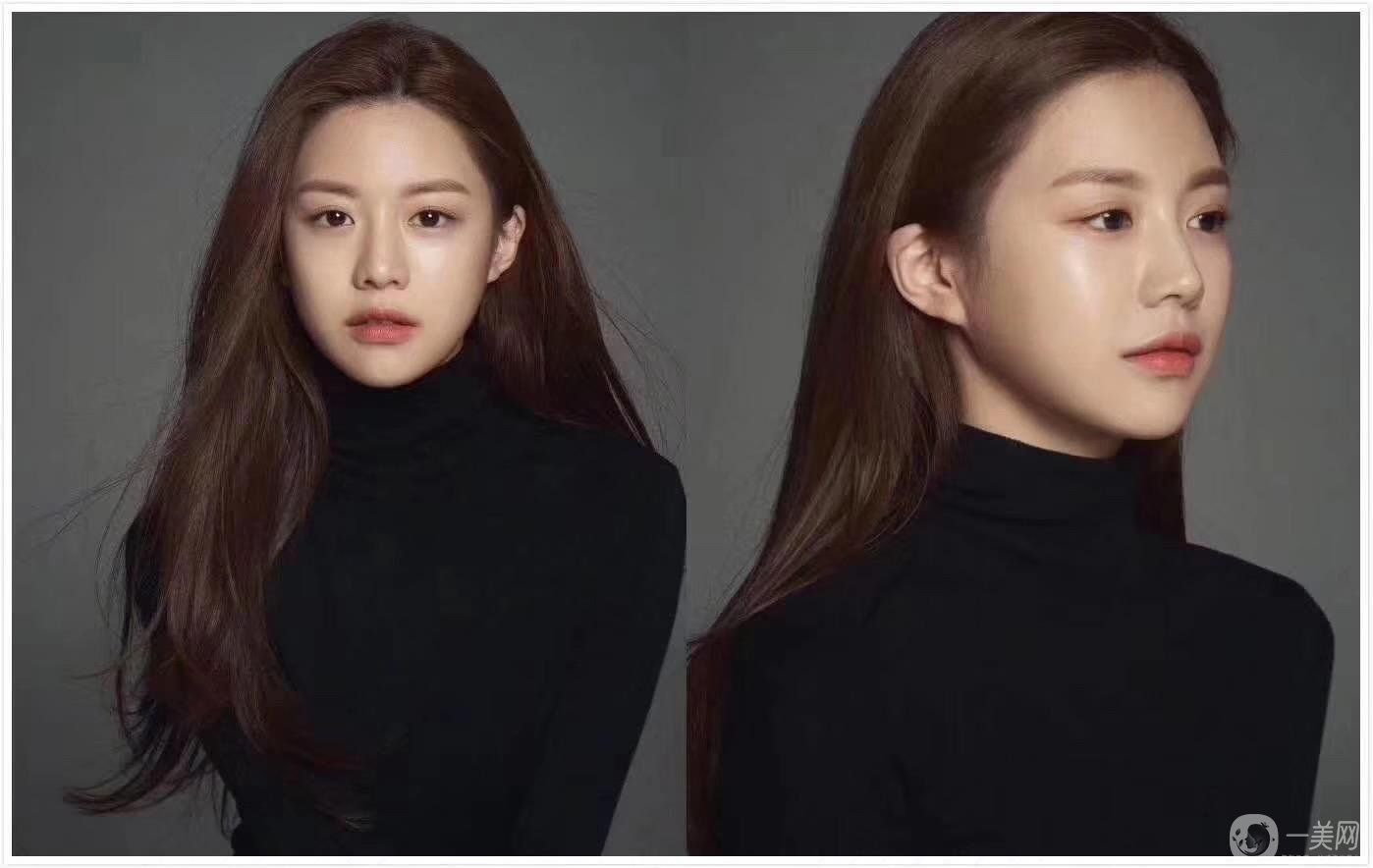 重慶做雙眼皮要多少錢 割雙眼皮喲風(fēng)險(xiǎn)嗎