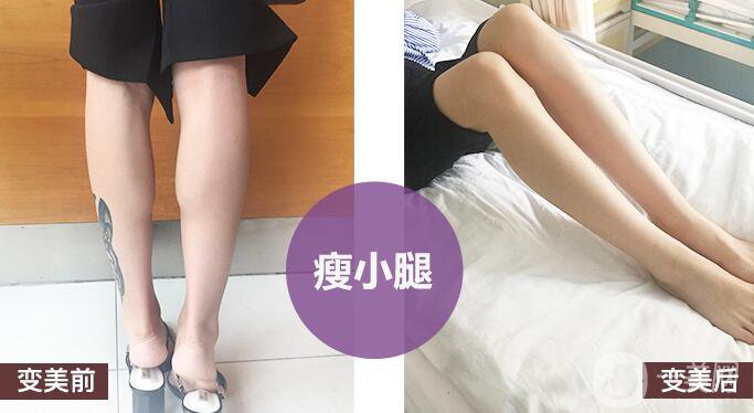 打*有副作用嗎？都有哪些副作用呢？