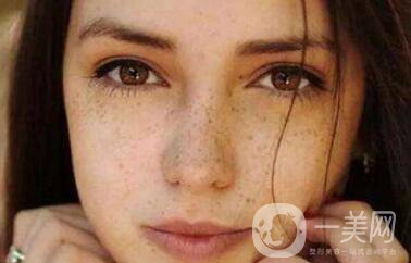 紅寶石激光祛斑*果,紅寶石激光祛斑術(shù)后注意事項