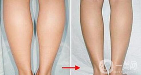 打*多少錢(qián),*價(jià)格