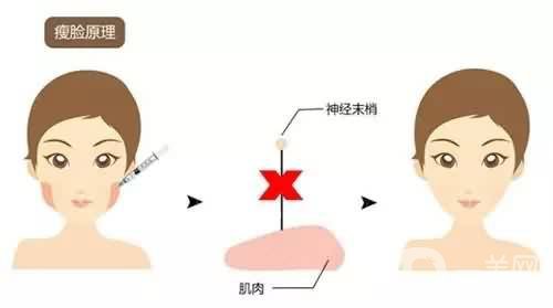 *一針要多少錢(qián) *的藥*是*的嗎