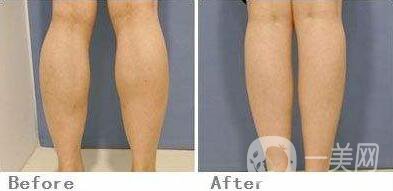 *會反彈嗎 *的*果怎么樣