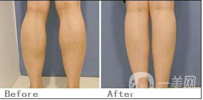 **價(jià)格,**注意事項(xiàng)