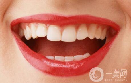 種植牙的過程 種植牙齒的種類有哪些？