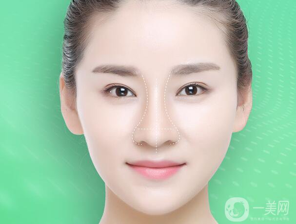 北京鼻骨矯正術(shù)多少錢 鼻骨矯正會(huì)留疤痕嗎