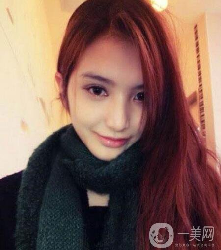 下頜整形手術的方法有哪些？