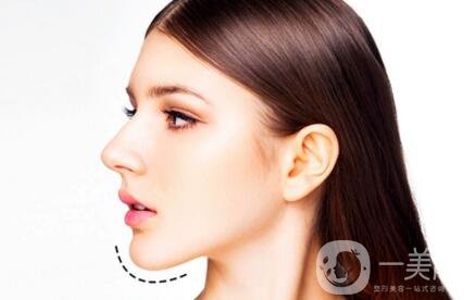 自體脂肪墊下巴恢復(fù)期是怎樣的？如何做好術(shù)后護(hù)理？