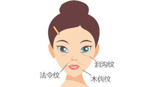 玻尿酸填充淚溝的危害 *果怎么樣