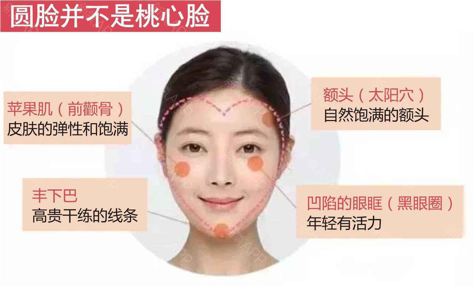 脂肪填充維持多久時間 有副作用嗎