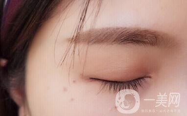 上海九院開眼角價格|*果測評