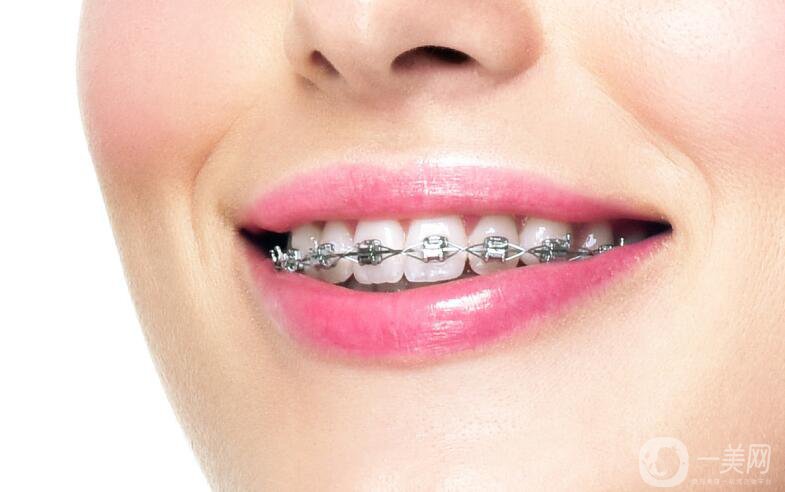 天包地怎么慢慢矯正 天包地是怎么產(chǎn)生的？