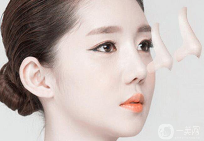 隆鼻哪種好 該如何選擇適合自己的方式？