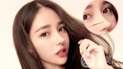 隆鼻哪種好 該如何選擇適合自己的方式？