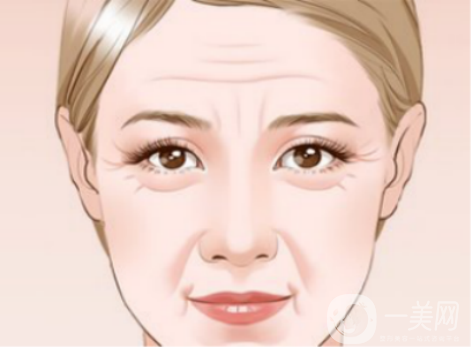 去皺多少錢(qián) 去皺費(fèi)用是多少 祛皺的方法