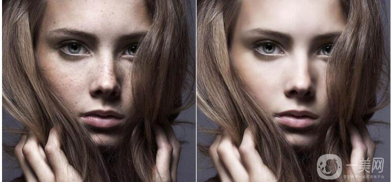 祛斑的價錢是多少 祛斑的方法有哪些