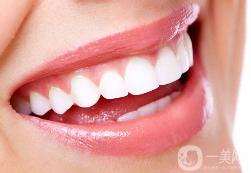 仿生美容冠多少錢 仿生美容冠的*果怎么樣