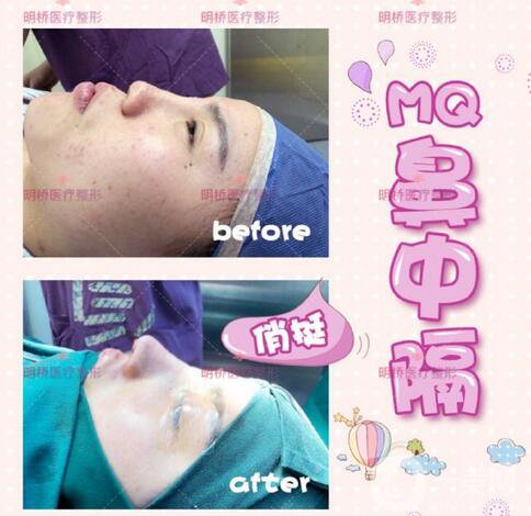 上海明僑整形美容門診部