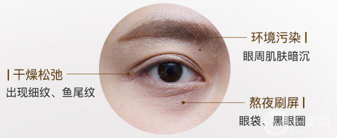 調(diào)節(jié)魚尾紋的方法有哪些 哪種比較適合你？