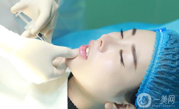 自體脂肪墊下巴貴嗎 一般多少錢(qián)？