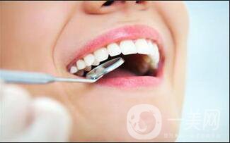 皓齒美白牙齒多少錢,皓齒美白牙齒費用分析