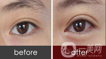 北京豐臥蠶貴嗎,北京豐臥蠶多少錢(qián)