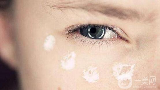 超聲法去眼袋價格,超聲法去眼袋術(shù)后護理