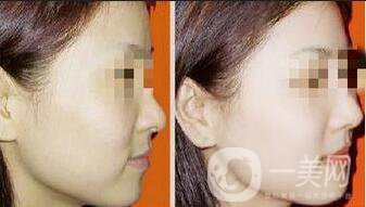 黑臉娃娃*果照,黑臉娃娃價(jià)格