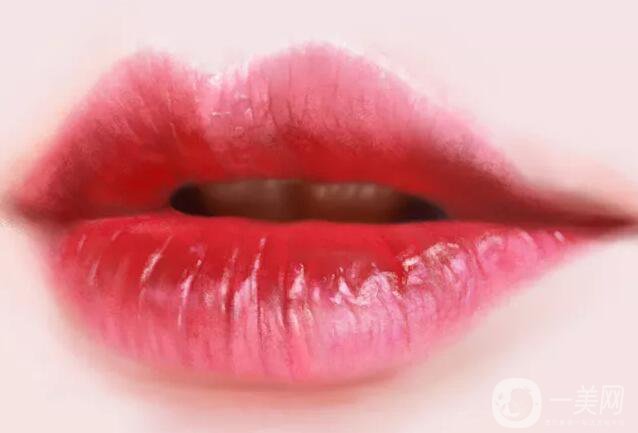 豐唇手術(shù)好嗎 有哪些手術(shù)方式呢？