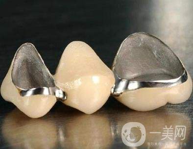 仿生美容冠好不好 *果怎么樣