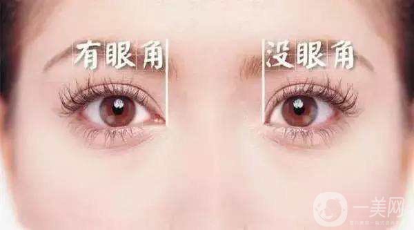 開眼角手術(shù)圖怎么樣 開眼角手術(shù)價(jià)格