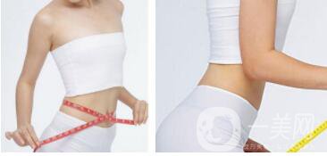 吸脂減肥價(jià)格 吸脂減肥適合什么人