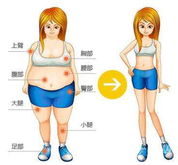 吸脂減肥價(jià)格 吸脂減肥適合什么人