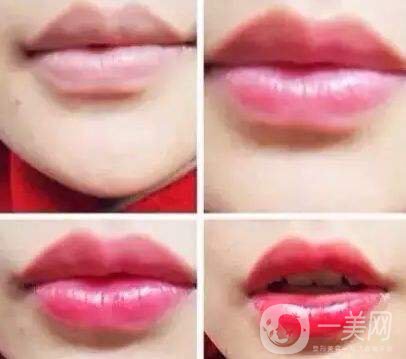 沃斯堡的長*減皺好不好 *果怎么樣?