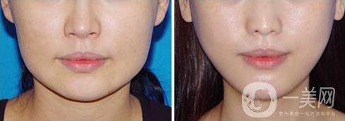 打*價(jià)格,*多久見*