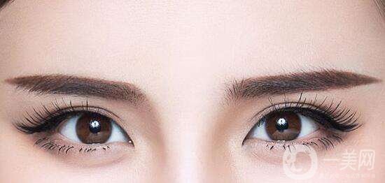 開眼角前后照片分享 開眼角好不好