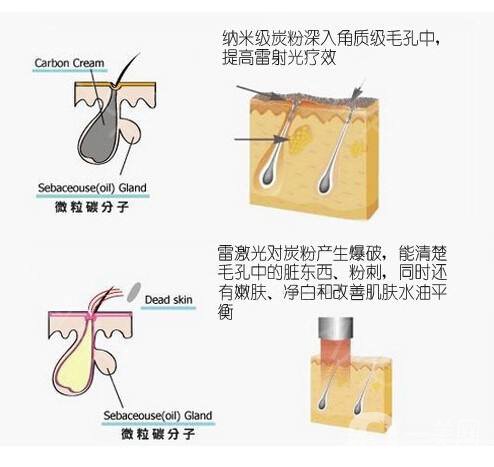 做黑臉娃娃費用多少 黑臉娃娃的作用是什么