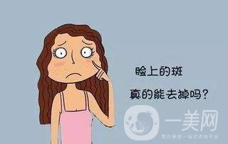 激光祛斑價格表 激光祛斑有副作用嗎