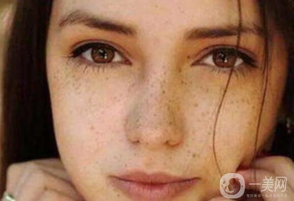 激光祛斑*果,激光祛斑優(yōu)勢