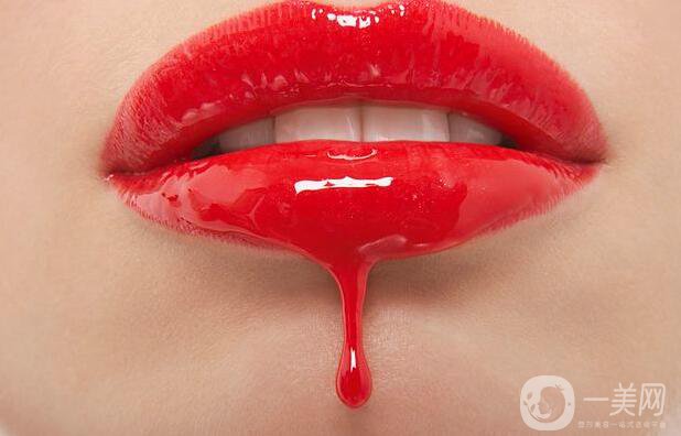 玻尿酸豐唇珠后需注意什么 該如何護(hù)理？