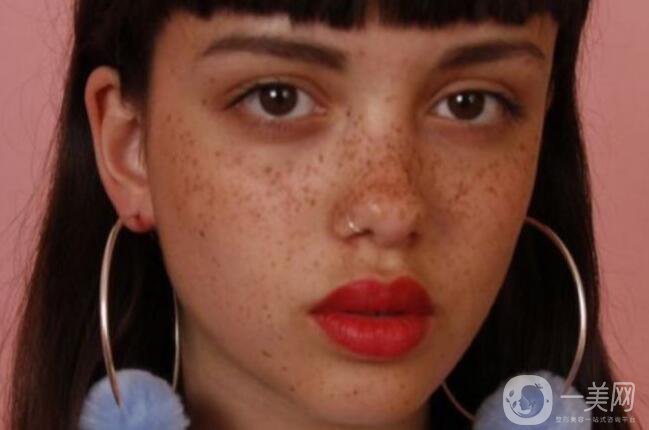 色素沉著如何處理 怎么去除？