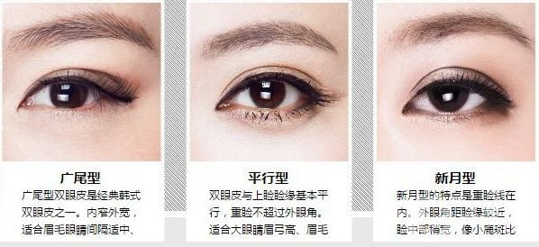 腫泡眼雙眼皮貴嗎 腫泡眼雙眼皮手術(shù)的價格