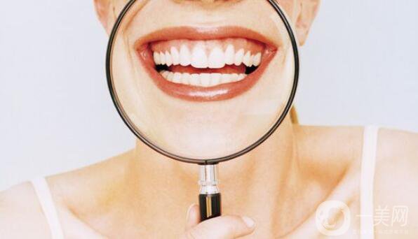 烤瓷牙種類及價格 你知道多少?