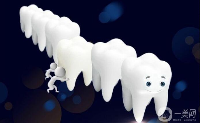 烤瓷牙種類及價格 你知道多少?