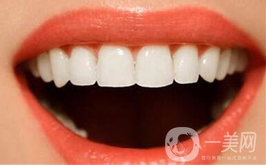 美容冠多少錢一顆,美容冠注意事項